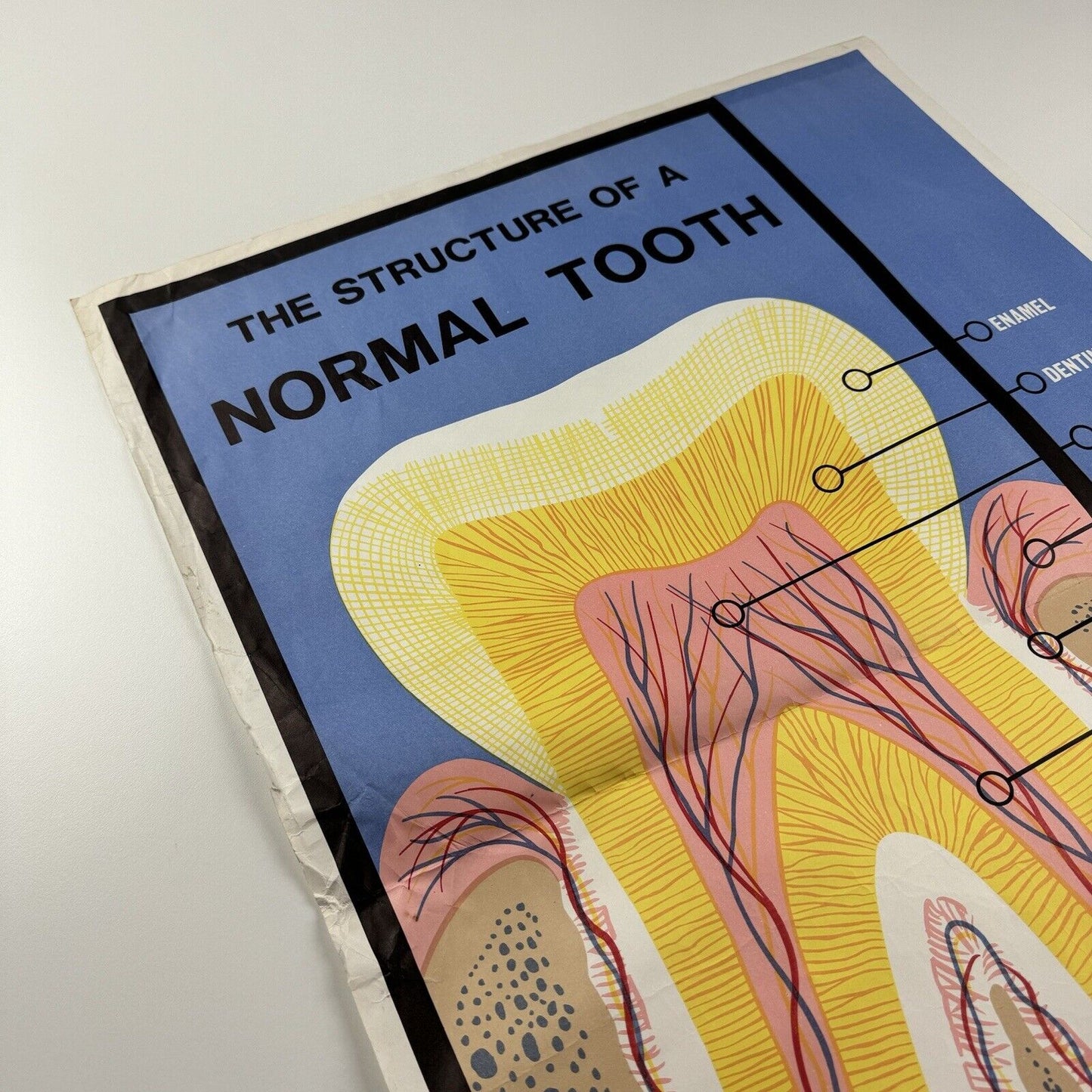 The Structure of a Normal Tooth | General Dental Council public information poster | Undated